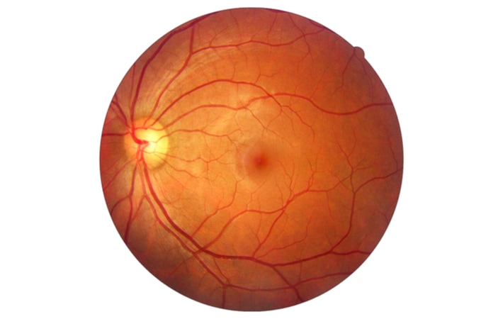 Retina - York Eye Care